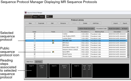 Sequence Protocol Manager for MR