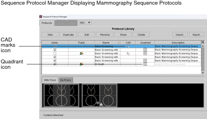 Sequence Protocol Manager for Mammo